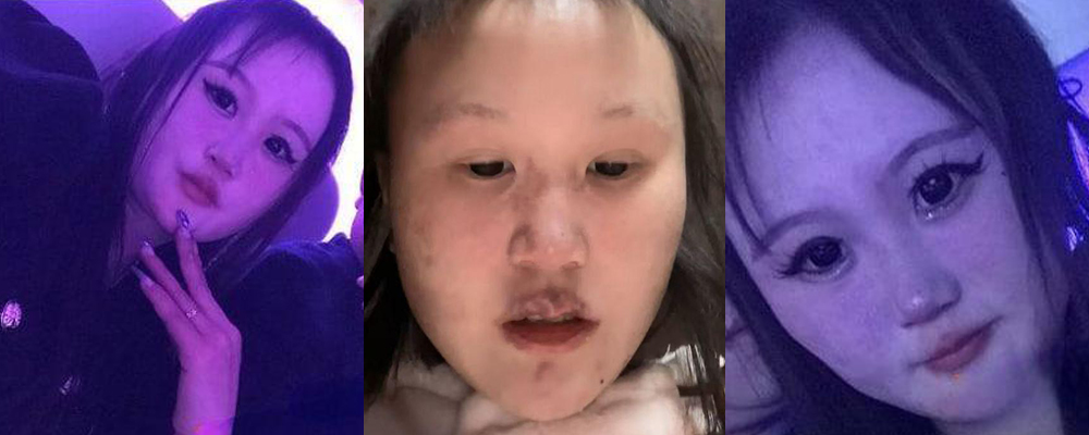 成都惊现生化母体 00后学生妹吴思婷隐瞒性病疯狂约炮 恶意传播病毒报复社会