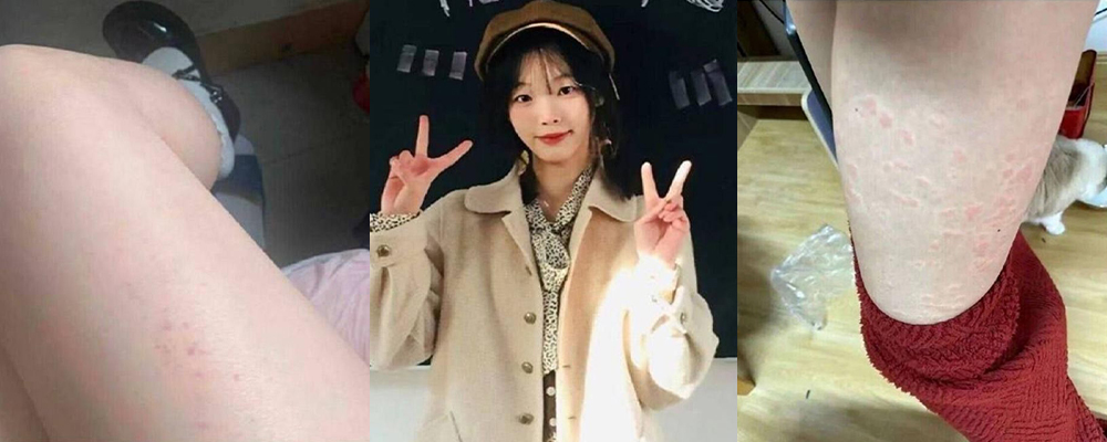 梅疣事 艾就一个滋 百度贴吧艾滋病论坛 清纯少女讲诉得艾经历 与猥琐大叔厕所打炮视频遭全网疯传