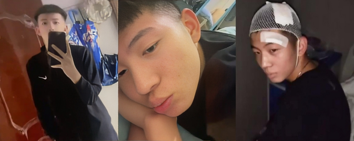 被抓奸打到医院缝20针 竟然还在病床上偷情 伤疤都没好就忘了痛 山东济宁泗水村书记逆子周恒勾搭有夫之妇程妍妍黑料曝光  
