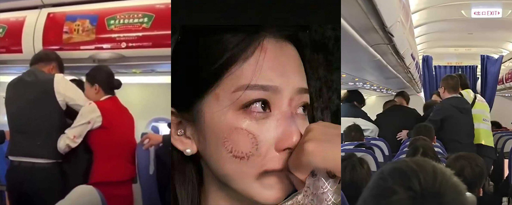 太离谱 两女子飞机上互嫌味道刺鼻打架 深航空姐劝架被咬伤 咬人现场视频流出 脸上咬痕触目惊心
